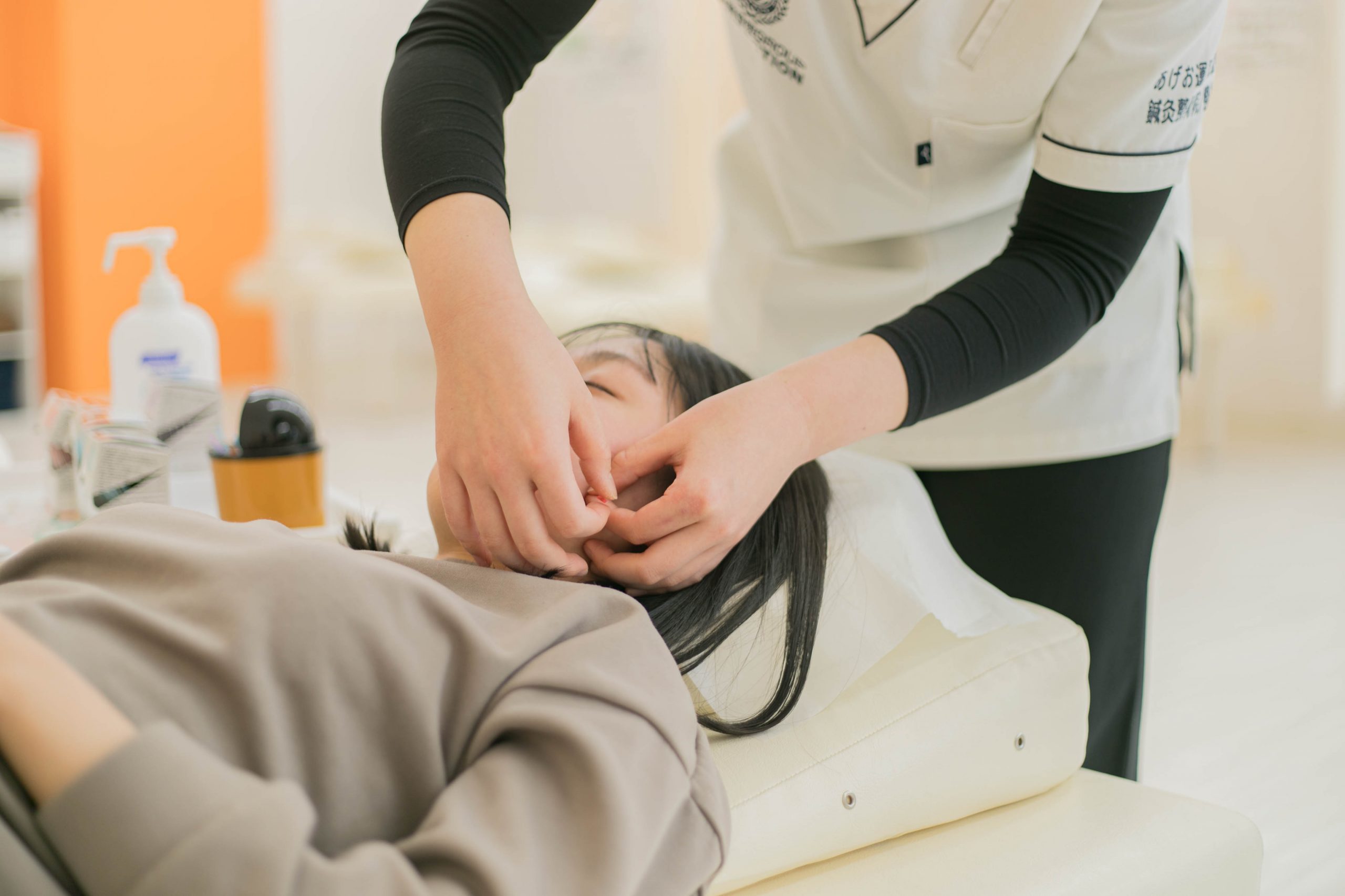 美容鍼 イメージ